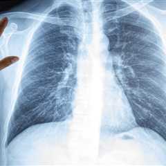 New AI tech to be rolled out at 64 NHS hospitals to help spot deadly lung cancer faster