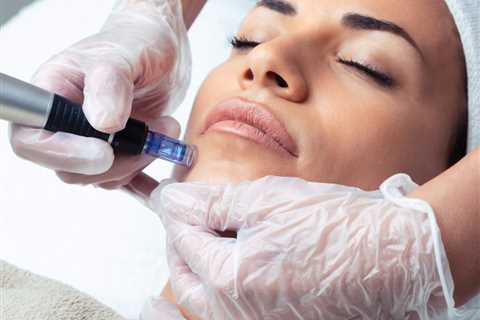 How Long After Hydrafacial Can I Get Microneedling