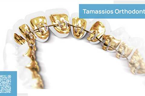 Standard post published to Tamassios Orthodontics - Orthodontist Nicosia, Cyprus at October 13,..