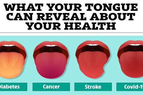 The 5 things your tongue can reveal about your health