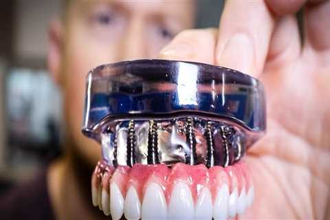 Transform Your Smile With Teeth Implants: Finding The Best Dental Implants Dentist In Pflugerville, ..