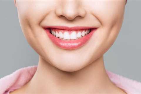 Natures Smile Review: From Skepticism To Satisfaction In Gum Health - Buy A Smile