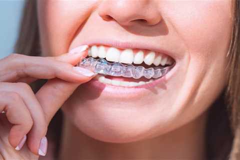 Do You Have to Wear a Retainer Forever After Invisalign?