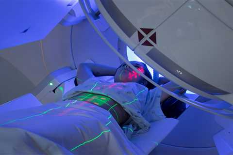 Radiation Dose May Increase Risk of Colorectal Cancer in Hodgkin Lymphoma Survivors