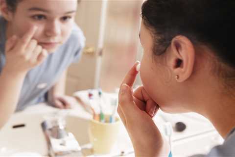 Understanding Tretinoin: The Prescription-Only Treatment for Acne