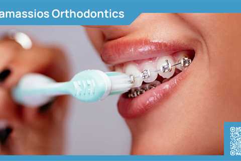 Standard post published to Tamassios Orthodontics - Orthodontist Nicosia, Cyprus at March 08, 2024..