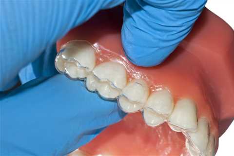 How Comfortable Are Clear Aligners: Understanding Wearability and Convenience