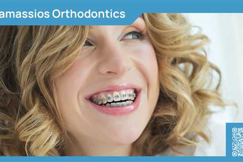 Standard post published to Tamassios Orthodontics - Orthodontist Nicosia, Cyprus at March 29, 2024..