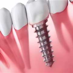 Can dental implants cause health issues?