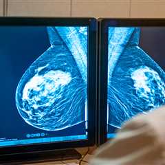 Breakthrough Breast Cancer Drug Faces NHS Approval Hurdle