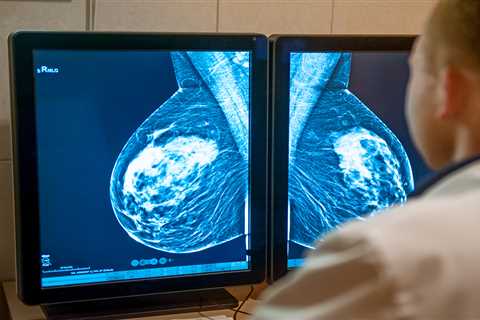 Breakthrough Breast Cancer Drug Faces NHS Approval Hurdle