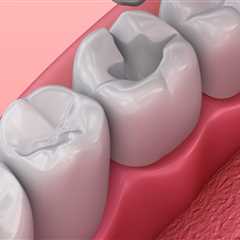 Understanding the Different Types of Dental Fillings