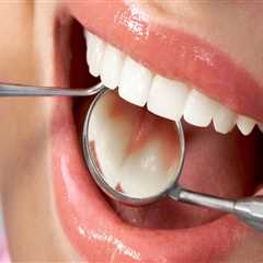 Understanding the Process of Getting a Dental Filling