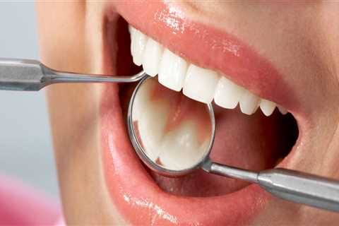 Understanding the Process of Getting a Dental Filling