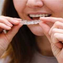 Can Clear Aligners Fix Crowded Teeth?