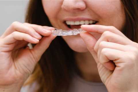 Can Clear Aligners Fix Crowded Teeth?