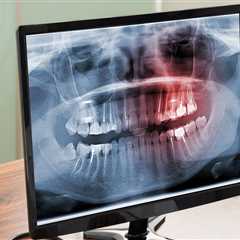 Why X-Rays Are Essential For Emergency Dental Care In Rockville, MD