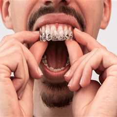 Finding a Qualified Invisalign Dentist Near You