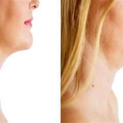 The Truth About Nonsurgical Fat Reduction And Double Chin Liposuction In NYC