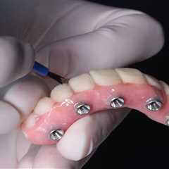 All-on-4 Dental Implants | Edental Perth