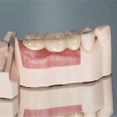 Fixed Implant Bridge | Edental Perth