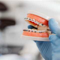 How Braces Help with Long-Term Dental Health for Teens in Marietta