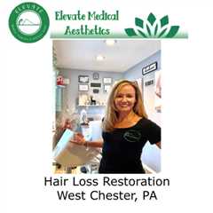 Hair Loss Restoration West Chester, PA