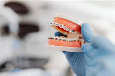 How Braces Help with Long-Term Dental Health for Teens in Marietta