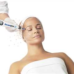 At-Home vs Professional Microneedling: Pros, Cons & Is It Worth The Risk?