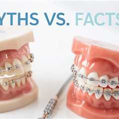 Metal Orthodontic Braces: Myths vs. Facts
