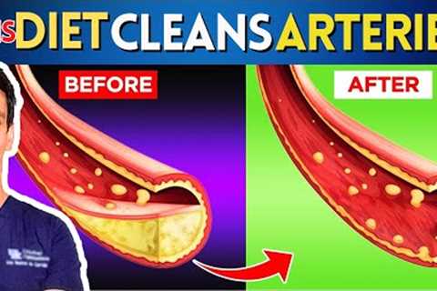Best Diet to UNCLOG Arteries