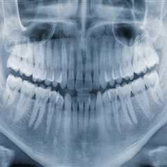 How Dental X-Rays Help Detect Problems Before They Become Serious