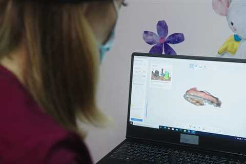 How to Use 3D Scanning for Digital Treatment Planning