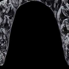 Achieve a Perfect Smile with Invisalign in Mill Creek