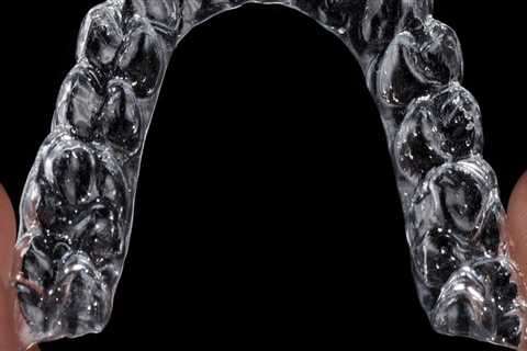 Achieve a Perfect Smile with Invisalign in Mill Creek