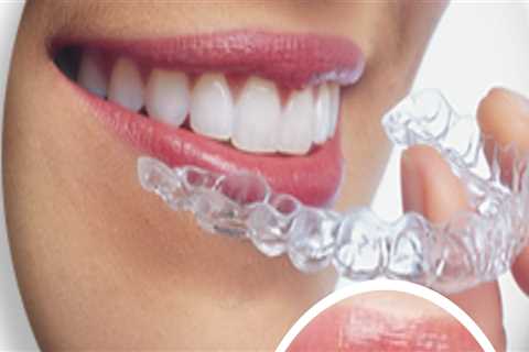 Straighten Your Smile with Invisalign in Yorktown Heights