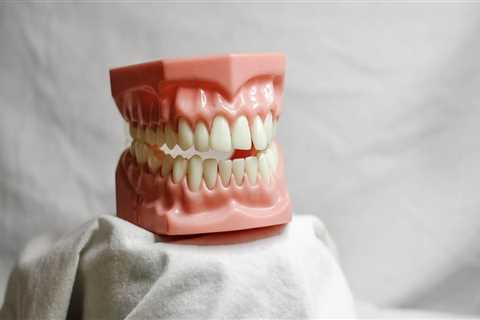 Discover Top Invisalign Dentist Services in Somerville