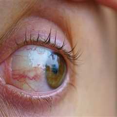 Understanding Eye Care Services: Treatments for Common Eye Conditions