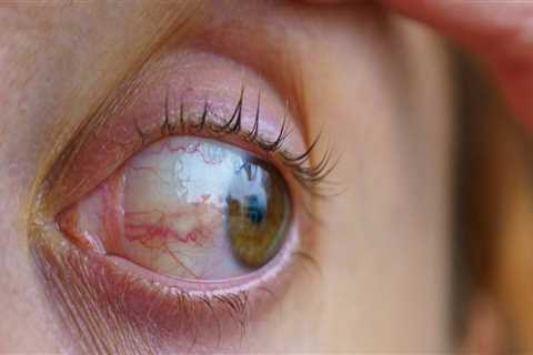 Understanding Eye Care Services: Treatments for Common Eye Conditions