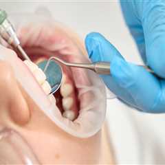 Essential Tips for Keeping Your Teeth Clean Between Professional Cleanings