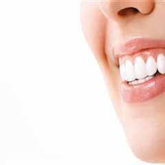 Understanding the Ideal Frequency for Teeth Cleaning