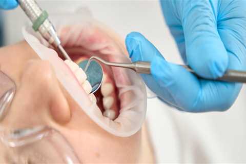 Essential Tips for Keeping Your Teeth Clean Between Professional Cleanings