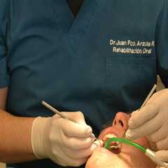 Understanding Teeth Extraction Before Cleaning in Georgetown