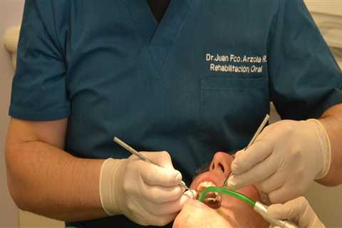 Understanding Teeth Extraction Before Cleaning in Georgetown