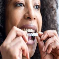 The Benefits of Invisalign Clear Braces in Contemporary Dentistry