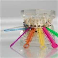 Braces and Colors: Guide to Choosing the Right Shade