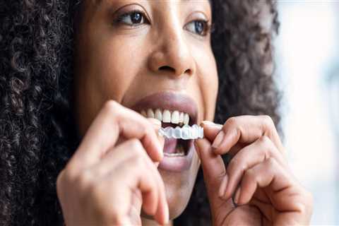 The Benefits of Invisalign Clear Braces in Contemporary Dentistry